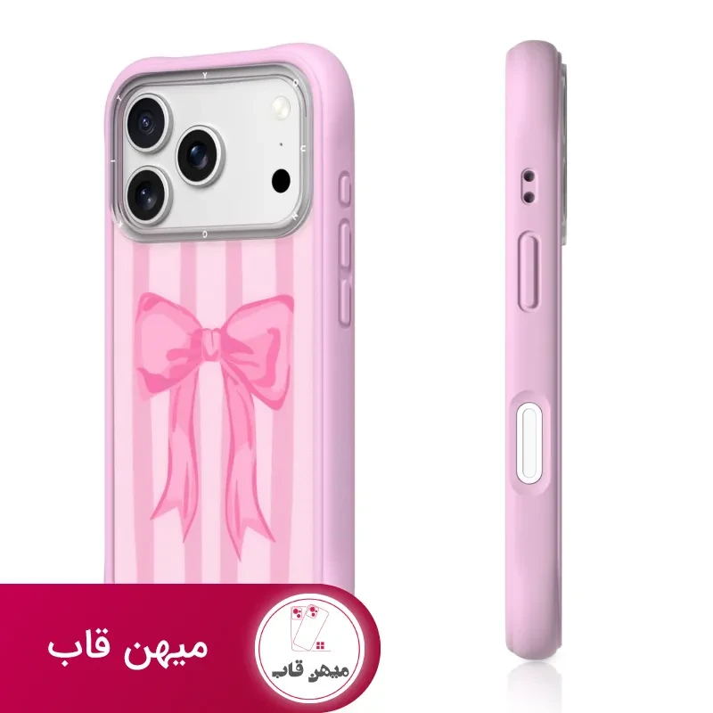 قاب یانگ کیت آیفون Papion پاپیون راه راه صورتی
