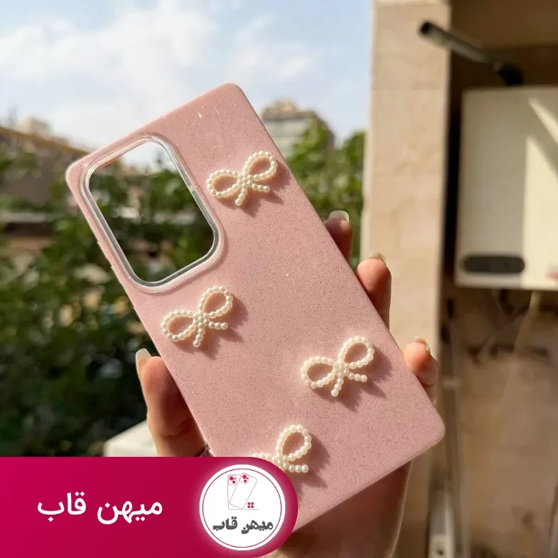 قاب شیائومی شاین پاپیون مرواریدی SHINY BOW XIAOMI