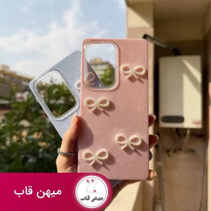 قاب شیائومی شاین پاپیون مرواریدی SHINY BOW XIAOMI