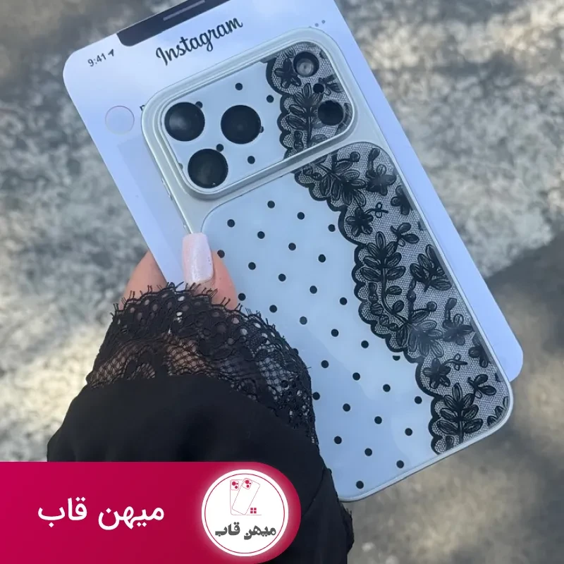 قاب گوشی دانتل دات