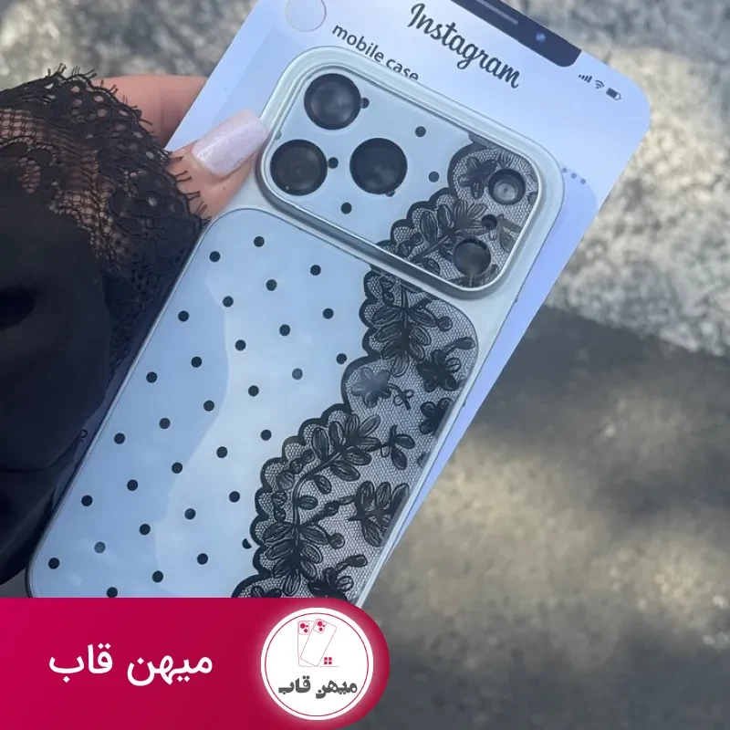 قاب گوشی دانتل دات